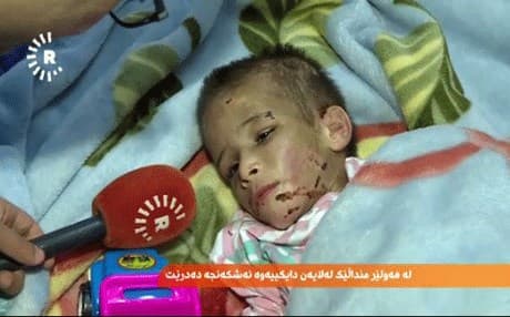 اربيل.. أم تعذب طفلها بطريقة بشعة وتحرمه من الطعام لشهرين