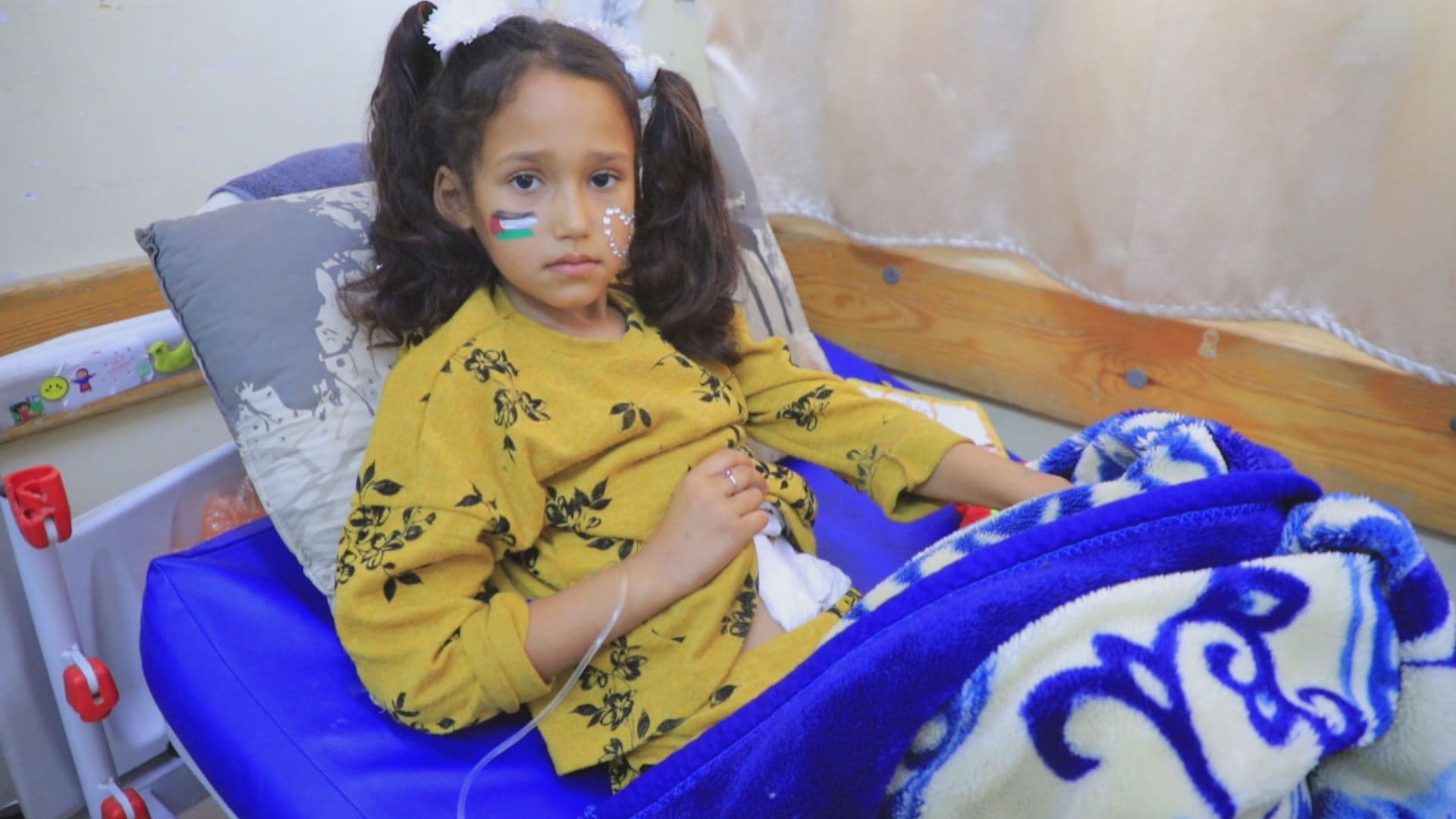 أزمة صحية تهدد آلاف الجرحى بينهم أطفال في غزة 