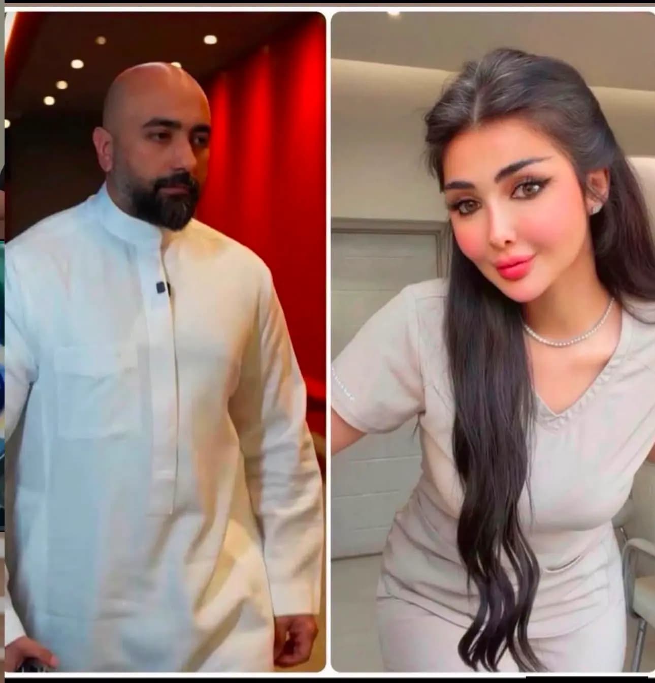 طبيب تجميل في بغداد يحرق وجه زوجته