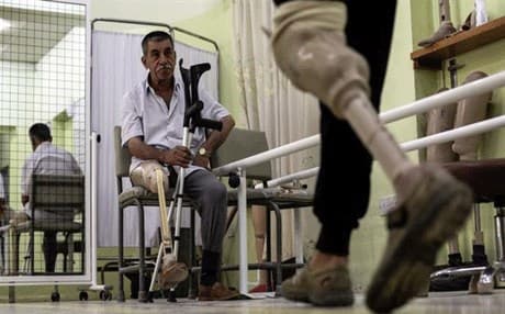 الأمم المتحدة: 4800 شخص فقدوا أطرافهم بسبب الحرب في الموصل