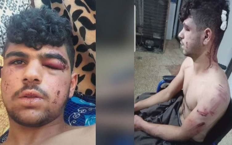 دليار مجيد سليمان أحد الشبان الثلاثة الذين تعرضوا للتعذيب على يد الجندرمة التركية